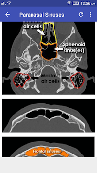 CT Scan Cross Sectional Anatomy for PC screenshot 2