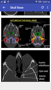 CT Scan Cross Sectional Anatomy for PC screenshot 3