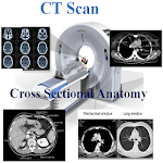 CT Scan Cross Sectional Anatomy for PC