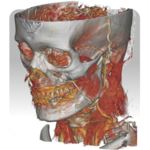DroidRender - 3D DICOM viewer for PC