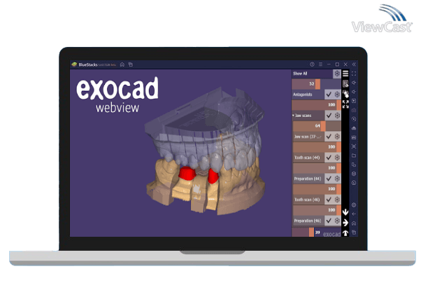 Run exocad webview - Free STL OBJ and 3D Model Viewer on PC